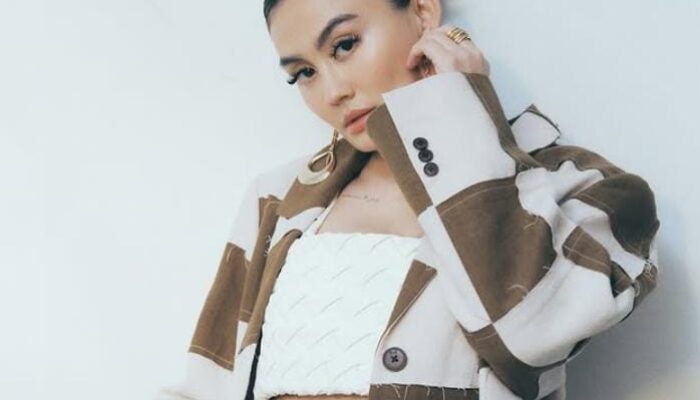 Agnez Mo Ungkap Perjuangannya Lawan Alopecia Areata